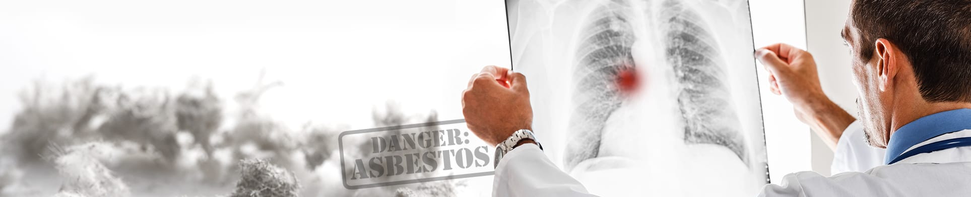 Mesothelioma Lawyer Middlesex County NJ  Asbestos Lawyers New Jersey